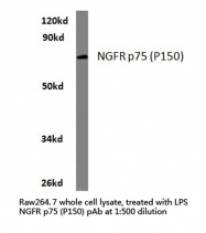 AP20406PU-N - CD271 / NGFR