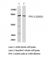 AP20430PU-N - PFKL