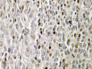 AP20439PU-N - FOXE3 / FKHL12