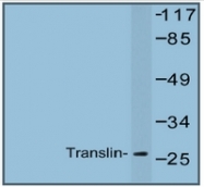 AP20446PU-N - Translin (TSN)