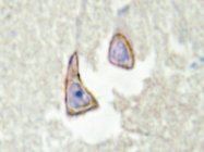 AP20447PU-N - Kinase suppressor of Ras 2