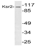 AP20447PU-N - Kinase suppressor of Ras 2