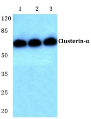 AP20482PU-N - Apolipoprotein J / Apo J