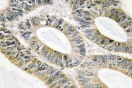 AP20489PU-N - Galectin-9
