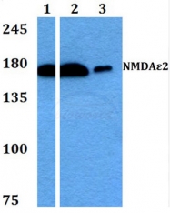AP20498PU-N - NMDAR2B
