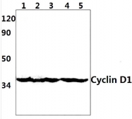 AP20500PU-N - Cyclin D1