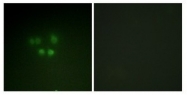AP20504PU-N - Nibrin
