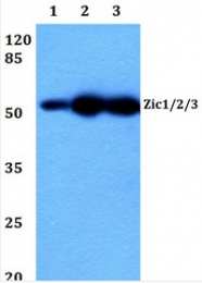 AP20514PU-N - ZIC1