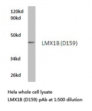 AP20515PU-N - LMX1B