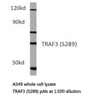 AP20520PU-N - TCF3 / E2A