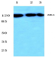 AP20540PU-N - ABL1