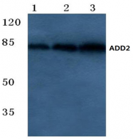AP20545PU-N - Beta-adducin (ADD2)