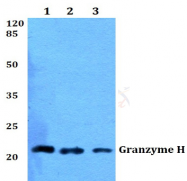 AP20560PU-N - Granzyme H (GZMH)