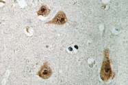 AP20568PU-N - Annexin A1 / ANXA1