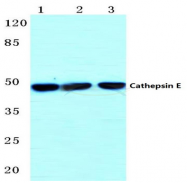 AP20573PU-N - Cathepsin E