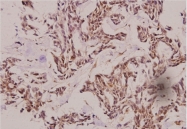 AP20573PU-N - Cathepsin E