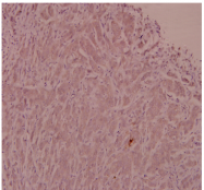 AP20574PU-N - Adrenomedullin / ADM