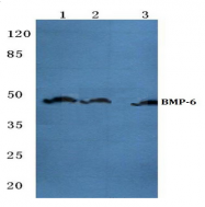 AP20577PU-N - BMP6
