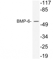 AP20577PU-N - BMP6