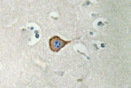 AP20586PU-N - CNPase
