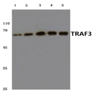 AP20591PU-N - TRAF3 / CRAF1