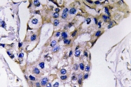 AP20595PU-N - Interleukin-5 / IL5