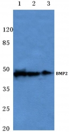 AP20597PU-N - BMP2 / BMP2A