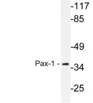 AP20616PU-N - PAX1