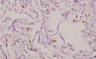 AP20628PU-N - Interleukin-1 beta / IL-1B
