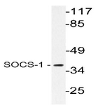 AP20630PU-N - SOCS1