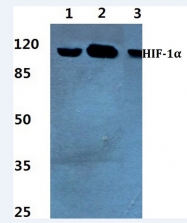 AP20633PU-N - HIF1A / HIF1 alpha