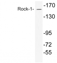 AP20652PU-N - ROCK1