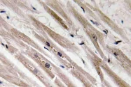 AP20655PU-N - Caspase-12