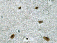 AP20677PU-N - MAP kinase p38 alpha / MAPK14