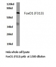 AP20682PU-N - FOXO1A