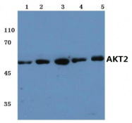AP20689PU-N - AKT2 / PKB beta