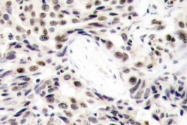 AP20704PU-N - RELA / NF-kB p65