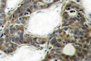 AP20705PU-N - Catenin beta-1