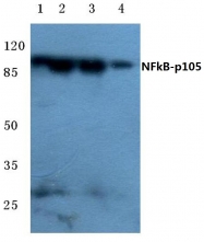 AP20731PU-N - NF-kB p105 / p50