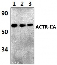 AP20763PU-N - Activin receptor type 2A / ACVR2A