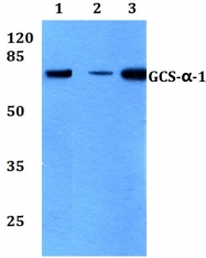 AP20764PU-N - Guanylate cyclase soluble GUCY1A3