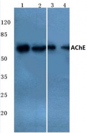 AP20787PU-N - Acetylcholinesterase