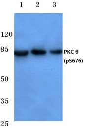 AP20801PU-N - PRKCQ / PRKCT