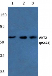 AP20812PU-N - AKT2 / PKB beta