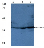 AP20824PU-N - NFKBIA / IKBA