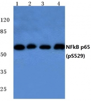 AP20825PU-N - RELA / NF-kB p65