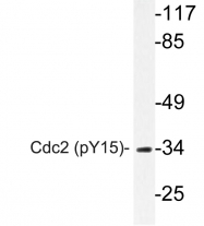 AP20844PU-N - CDK1