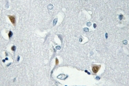 AP20846PU-N - Histone H2A.x