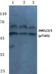 AP20849PU-N - JNK1/2/3