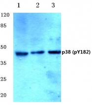 AP20851PU-N - MAP kinase p38